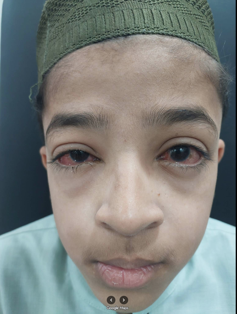 Patient consultation for eye care